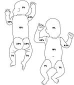 Drawing of Rule of nines, toddler e401013 - Search Clipart ...